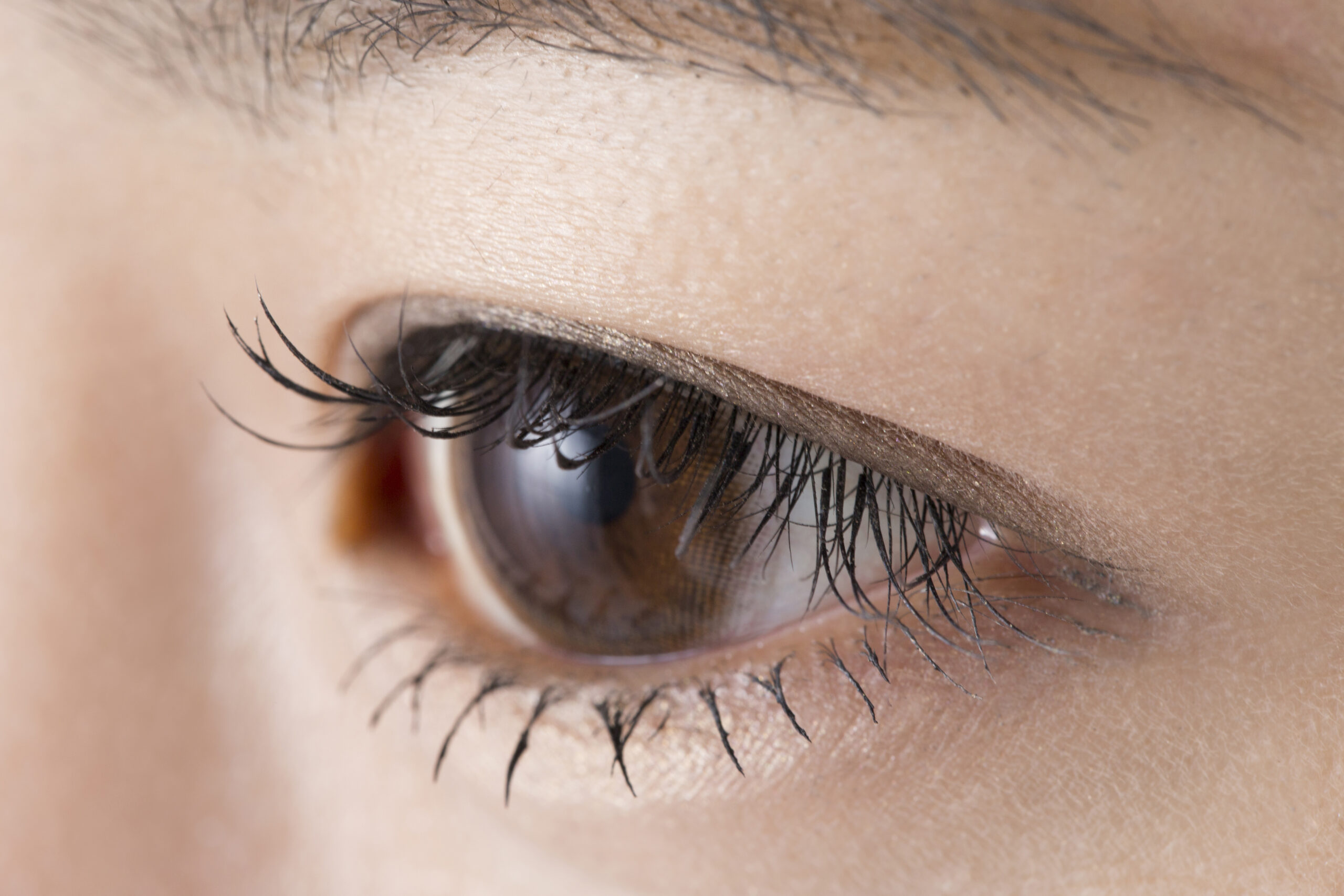 【山口県下関市】逆さまつげとは？症状や原因、治療法までわかりやすく解説